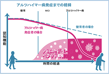 アルツハイマー病発症のメカニズム