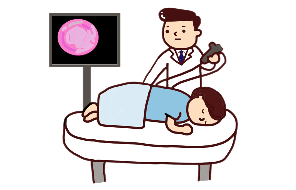 大腸カメラの場合