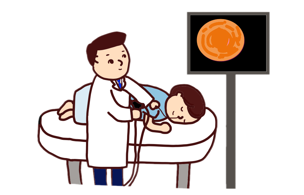 胃カメラの場合